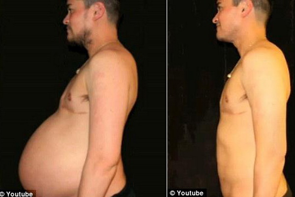 thomas beatie