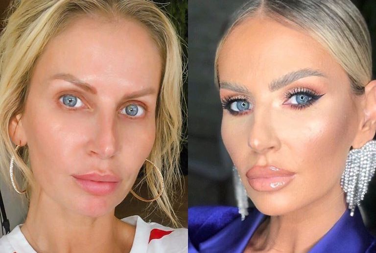 Andreea banica operatii estetice